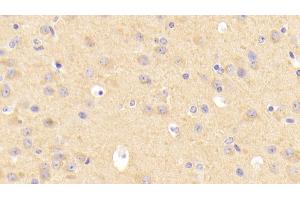 Detection of LDLR in Mouse Cerebrum Tissue using Polyclonal Antibody to Low Density Lipoprotein Receptor (LDLR)