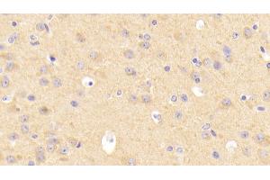 Detection of LDLR in Mouse Cerebrum Tissue using Polyclonal Antibody to Low Density Lipoprotein Receptor (LDLR) (LDLR anticorps  (AA 263-509))