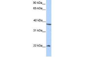 NEK7 antibody used at 1 ug/ml to detect target protein. (NEK7 anticorps)