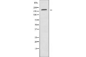 Western blot analysis of extracts from HUVEC cells, using ABCA8 antibody.