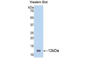 Western Blotting (WB) image for anti-S100 Calcium Binding Protein B (S100B) (AA 1-92) antibody (ABIN1078517) (S100B anticorps  (AA 1-92))