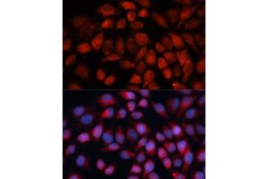 Immunofluorescence analysis of HeLa cells using ACADM antibody (ABIN3015656, ABIN3015657, ABIN1678521 and ABIN6219006) at dilution of 1:100 (40x lens). (Medium-Chain Specific Acyl-CoA Dehydrogenase, Mitochondrial (AA 1-220) anticorps)