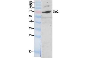 Western Blotting (WB) image for anti-Cytochrome C Oxidase Subunit II (COX2) antibody (ABIN5959232) (COX2 anticorps)