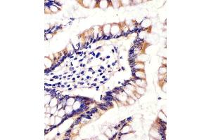 (ABIN655163 and ABIN2844780) staining CYP11B2 in human small intestine tissue sections by Immunohistochemistry (IHC-P - paraformaldehyde-fixed, paraffin-embedded sections). (CYP11B2 anticorps  (AA 120-147))