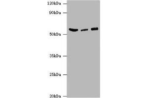 Western blot All lanes: HARS antibody at 6 μg/mL Lane 1: Hela whole cell lysate Lane 2: K562 whole cell lysate Lane 3: 293T whole cell lysate Secondary Goat polyclonal to rabbit IgG at 1/10000 dilution Predicted band size: 58, 53, 51, 55 kDa Observed band size: 58 kDa (HARS1/Jo-1 anticorps  (AA 1-180))