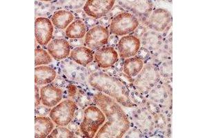 Immunohistochemical analysis of CD168 staining in human kidney formalin fixed paraffin embedded tissue section.