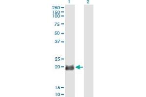 Western Blot analysis of EXOSC1 expression in transfected 293T cell line by EXOSC1 monoclonal antibody (M01), clone 2E9.