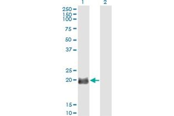 EXOSC1 anticorps  (AA 1-195)