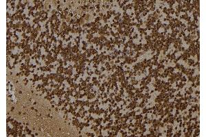 ABIN6261257 and ABIN6277502 at 1/100 staining Rat brain tissue by IHC-P. (DDX5 anticorps  (C-Term))