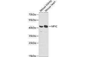 Western blot analysis of extracts of various cell lines, using NFYC antibody (ABIN6129066, ABIN6144604, ABIN6144605 and ABIN6225149) at 1:1000 dilution.