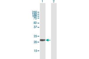 Western Blot analysis of RCVRN expression in transfected 293T cell line by RCVRN MaxPab polyclonal antibody.