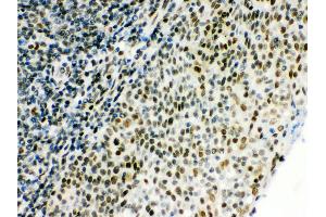 Anti- CTBP1 Picoband antibody, IHC(P) IHC(P): Human Tonsil Tissue (CTBP1 anticorps  (C-Term))