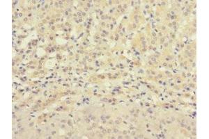 Immunohistochemistry of paraffin-embedded human adrenal gland tissue using ABIN7176327 at dilution of 1:100