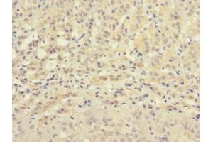 Immunohistochemistry of paraffin-embedded human adrenal gland tissue using ABIN7176327 at dilution of 1:100 (ZNF462 anticorps  (AA 2223-2506))