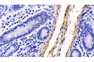 Detection of COL1a1 in Human Small intestine Tissue using Monoclonal Antibody to Collagen Type I Alpha 1 (COL1a1)