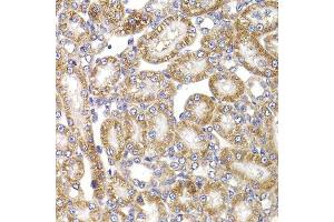 Immunohistochemistry of paraffin-embedded rat kidney using ANAPC5 antibody. (ANAPC5 anticorps  (AA 1-250))