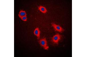 Immunofluorescent analysis of Caspase 9 staining in HeLa cells. (Caspase 9 anticorps  (Center))