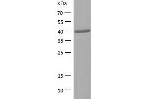 Western Blotting (WB) image for Aldolase B, Fructose-Bisphosphate (ALDOB) (AA 1-364) protein (His tag) (ABIN7121788) (ALDOB Protein (AA 1-364) (His tag))
