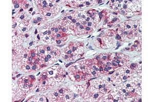 Anti-CYP11A1 antibody IHC of human adrenal.