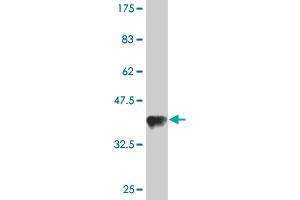 Western Blot detection against Immunogen (36. (TARS anticorps  (AA 44-143))