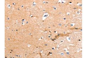 The image on the left is immunohistochemistry of paraffin-embedded Human brain tissue using ABIN7190856(GPR64 Antibody) at dilution 1/55, on the right is treated with synthetic peptide. (GPR64 anticorps)