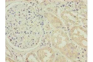 Immunohistochemistry of paraffin-embedded human kidney tissue using ABIN7173395 at dilution of 1:100 (TMLHE anticorps  (AA 16-376))