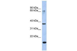 ARHGDIG antibody used at 1 ug/ml to detect target protein. (Ig anticorps)