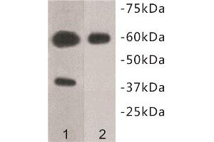Western Blotting (WB) image for anti-Transmembrane Protein 57 (TMEM57) antibody (ABIN1854993) (TMEM57 anticorps)