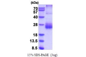 SDS-PAGE (SDS) image for serine Peptidase Inhibitor, Kunitz Type, 2 (SPINT2) (AA 28-197) protein (His tag) (ABIN5854267)