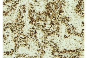 ABIN6273146 at 1/100 staining Human lung tissue by IHC-P. (NUFIP1 anticorps  (Internal Region))