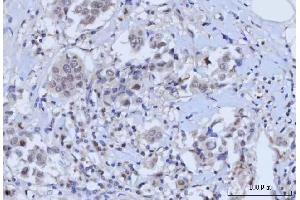 IHC analysis of RAD51C using anti-RAD51C antibody (ABIN7599718). (RAD51C anticorps  (AA 11-342))