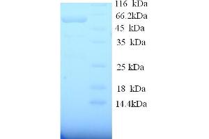 SDS-PAGE (SDS) image for Angiopoietin 1 (ANGPT1) (AA 20-497) protein (His tag) (ABIN5713222)