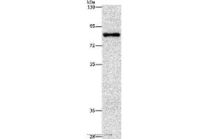 Western blot analysis of Hela cell, using NOL9 Polyclonal Antibody at dilution of 1:1250 (NOL9 anticorps)