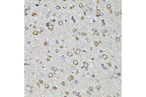 Immunohistochemistry of paraffin-embedded rat brain using FGF2 antibody. (FGF2 anticorps)