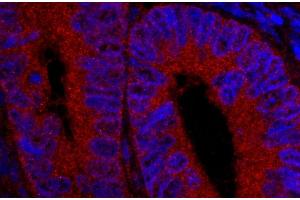 Immunofluorescence (IF) image for anti-Ubiquitin Specific Peptidase 5 (USP5) (AA 375-425) antibody (ABIN7449032) (USP5 anticorps  (AA 375-425))