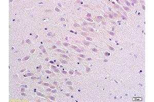 Formalin-fixed and paraffin embedded rat brain labeled with Anti Substance P Receptor/NK1R Polyclonal Antibody, Unconjugated  at 1:200 followed by conjugation to the secondary antibody Goat Anti-Rabbit IgG, PE conjugated -PE)used at 1:200 dilution for 40 minutes at 37°C.