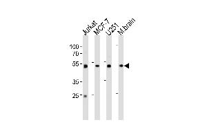 ENOA Antibody (C-term) (ABIN1882077 and ABIN2839495) western blot analysis in Jurkat,MCF-7, cell line and mouse brain tissue lysates (35 μg/lane). (ENO1 anticorps  (C-Term))