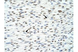 HKR1 antibody was used for immunohistochemistry at a concentration of 4-8 ug/ml to stain Myocardial cells (arrows) in Human Heart.