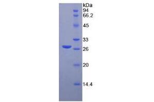 SDS-PAGE of Protein Standard from the Kit (Highly purified E. (MMP2 Kit CLIA)