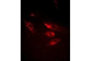 anti-SRSF Protein Kinase 1 (SRPK1) antibody