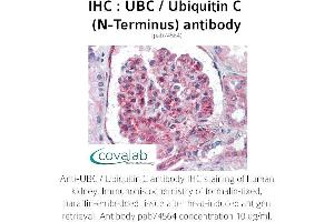 Image no. 1 for anti-Ubiquitin C (UBC) (N-Term) antibody (ABIN4889895) (UBC anticorps  (N-Term))