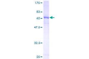 Image no. 1 for alpha 1 Microglobulin/bikunin precursor (AMBP) (AA 19-352) protein (GST tag) (ABIN1344968)