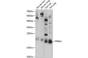 Western blot analysis of extracts of various cell lines, using PRRG2 antibody (ABIN7269558) at 1:1000 dilution.