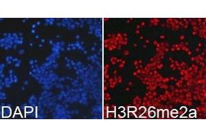 Immunofluorescence analysis of 293T cell using H3R26 me2a antibody. (Histone anticorps)