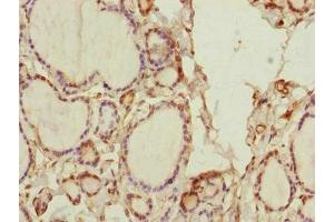 Immunohistochemistry of paraffin-embedded human thyroid tissue using ABIN7170585 at dilution of 1:100 (SPICE1 anticorps  (AA 1-220))