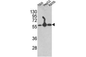 Western blot analysis of AP17615PU-N P4HB antibody (C-term) in CEM,HepG2, A2058 cell line lysates (35 µg/lane). (P4HB anticorps  (C-Term))