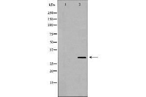 Western blot analysis of extracts of HL-60 , using TNFRSF14 antibody. (HVEM anticorps  (C-Term))