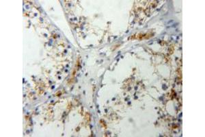 Used in DAB staining on fromalin fixed paraffin-embedded testis tissue