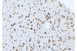 ABIN6273036 at 1/100 staining Mouse brain tissue by IHC-P.