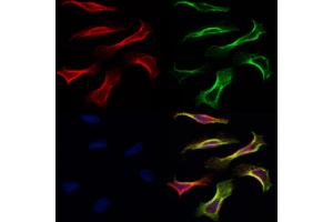 ABIN6260870 and ABIN6266837 staining Hela by IF/ICC. (Claudin 7 anticorps  (C-Term))
